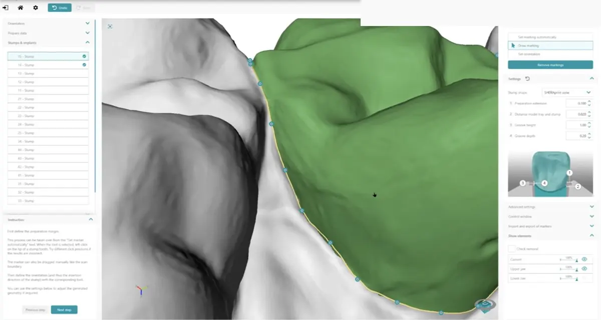 Digital margin marking on an alveolar model in CAD